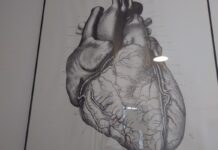 Amyloidoza – tajemnicza choroba