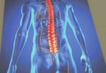 Osteoporoza zbiera równie wysokie żniwo jak koronawirus