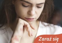 29 Października to Światowy Dzień Chorych na Łuszczycę