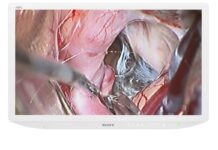 Sony wprowadza zaawansowany monitor medyczny