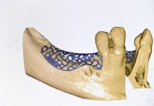 Technologia 3D coraz śmielej wkracza do stomatologii