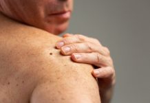 Aplikacja na smartfony ma zwiększyć wykrywalność nowotworów skóry