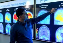 Do obrotu trafiły nowe leki na Alzheimera. Czy wreszcie się uda pokonać tę chorobę?