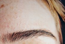 Świąd, plamy, stan zapalny? To może być chłoniak skóry!