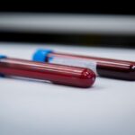 Hemofilia: nierówny dostęp do nowoczesnych terapii profilaktycznych fiolki z krwią