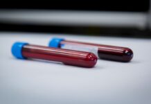 Hemofilia: nierówny dostęp do nowoczesnych terapii profilaktycznych fiolki z krwią