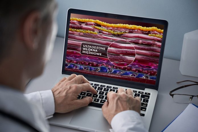 uszkodzone mięśnie lekarz przy laptopie. na ekranie obraz z napisem uszkodzone włókna mięśniowe