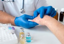 HS to nie tylko choroba skóry zmiany skórne na ręce chorego ogląda lekarz