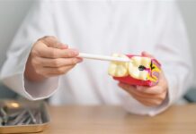 Próchnica zależy też od genów i składu śliny